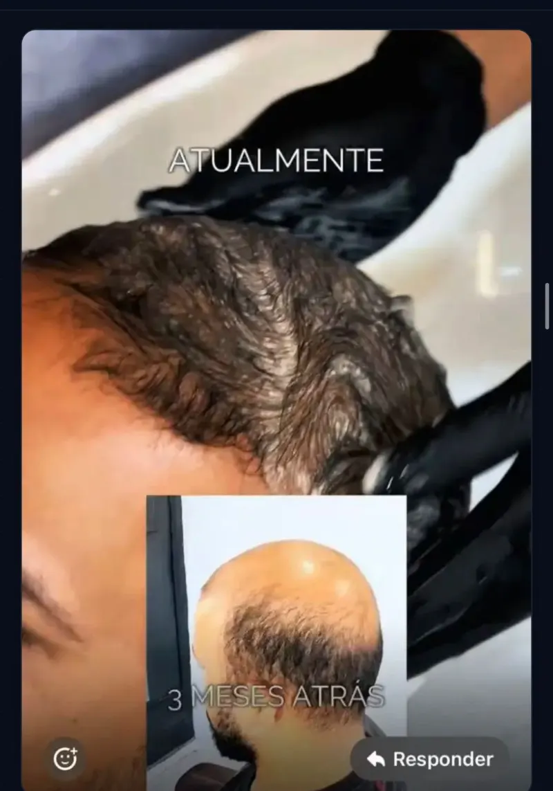 Antes e depois de 3 meses de protocolo